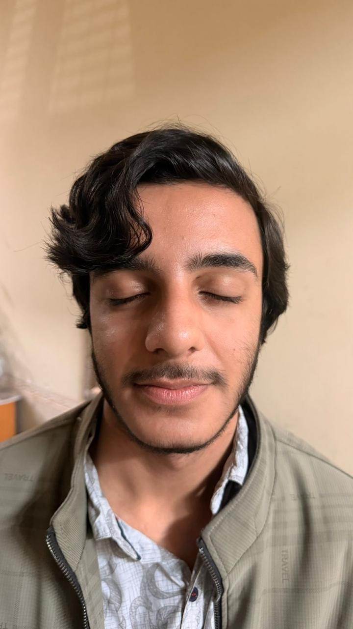 After Ear Reconstruction